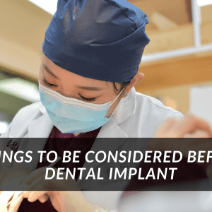 Read more about the article Things You Should Consider Before Getting Dental Implants