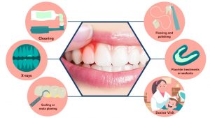 Gingivitis: Gum Disease Symptoms, Treatment, and Prevention