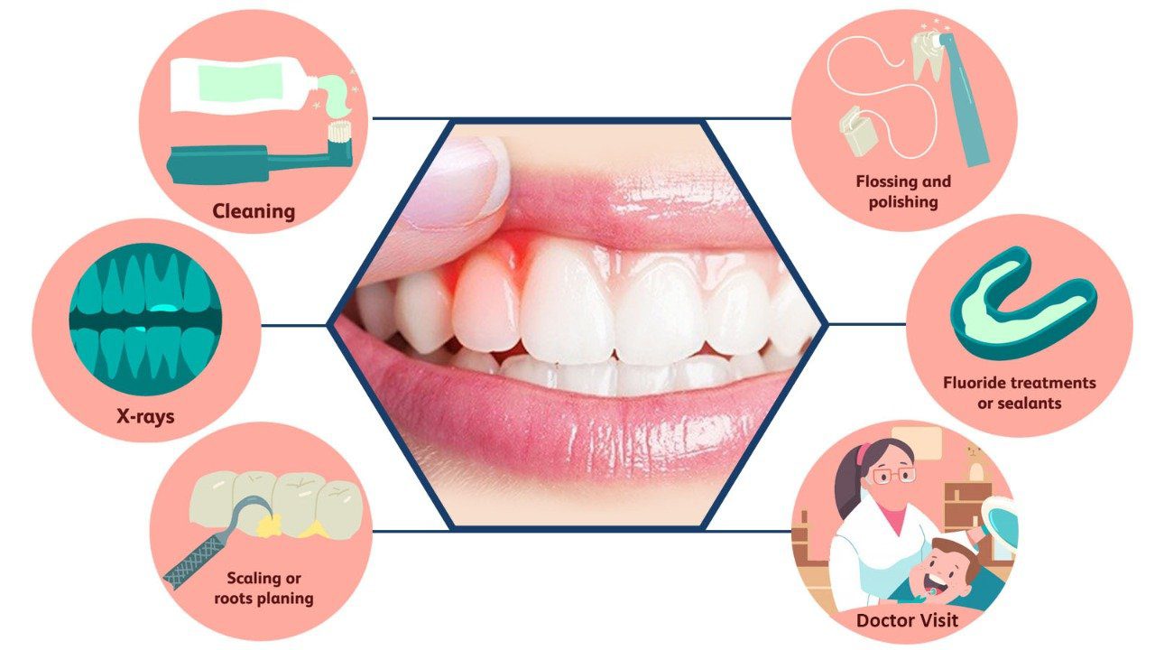 You are currently viewing Gingivitis: Gum Disease Treatment, Symptoms, and Prevention