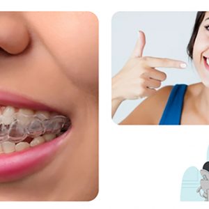 Read more about the article An Introduction To Invisalign In 5 Minutes!
