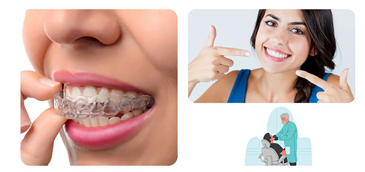 An Introduction To Invisalign In 5 Minutes!