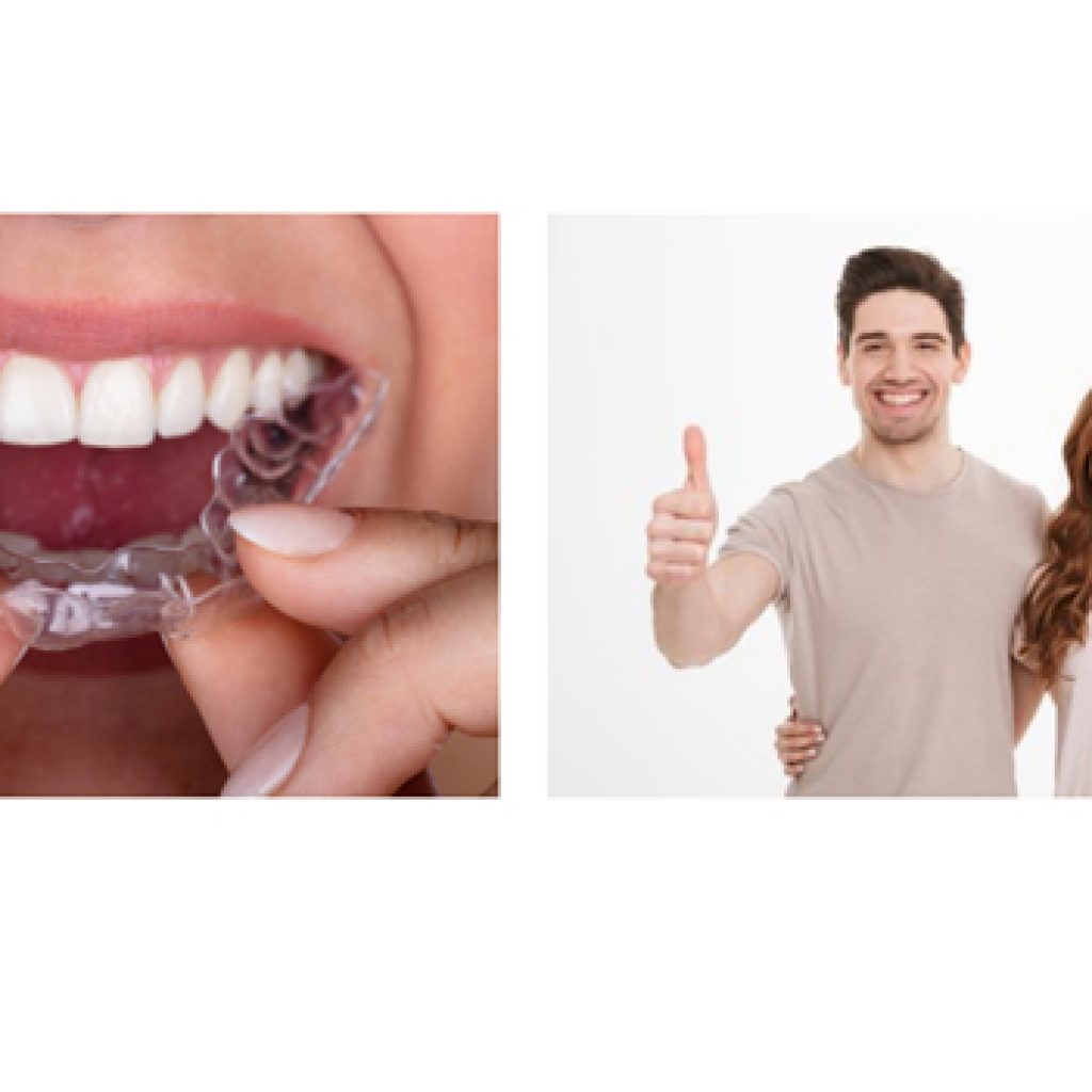 Invisalign Treatment Cost