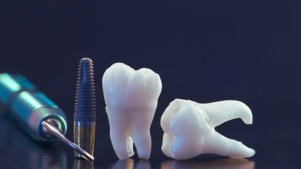 Dental Implants - Dental Implants Cost Australia