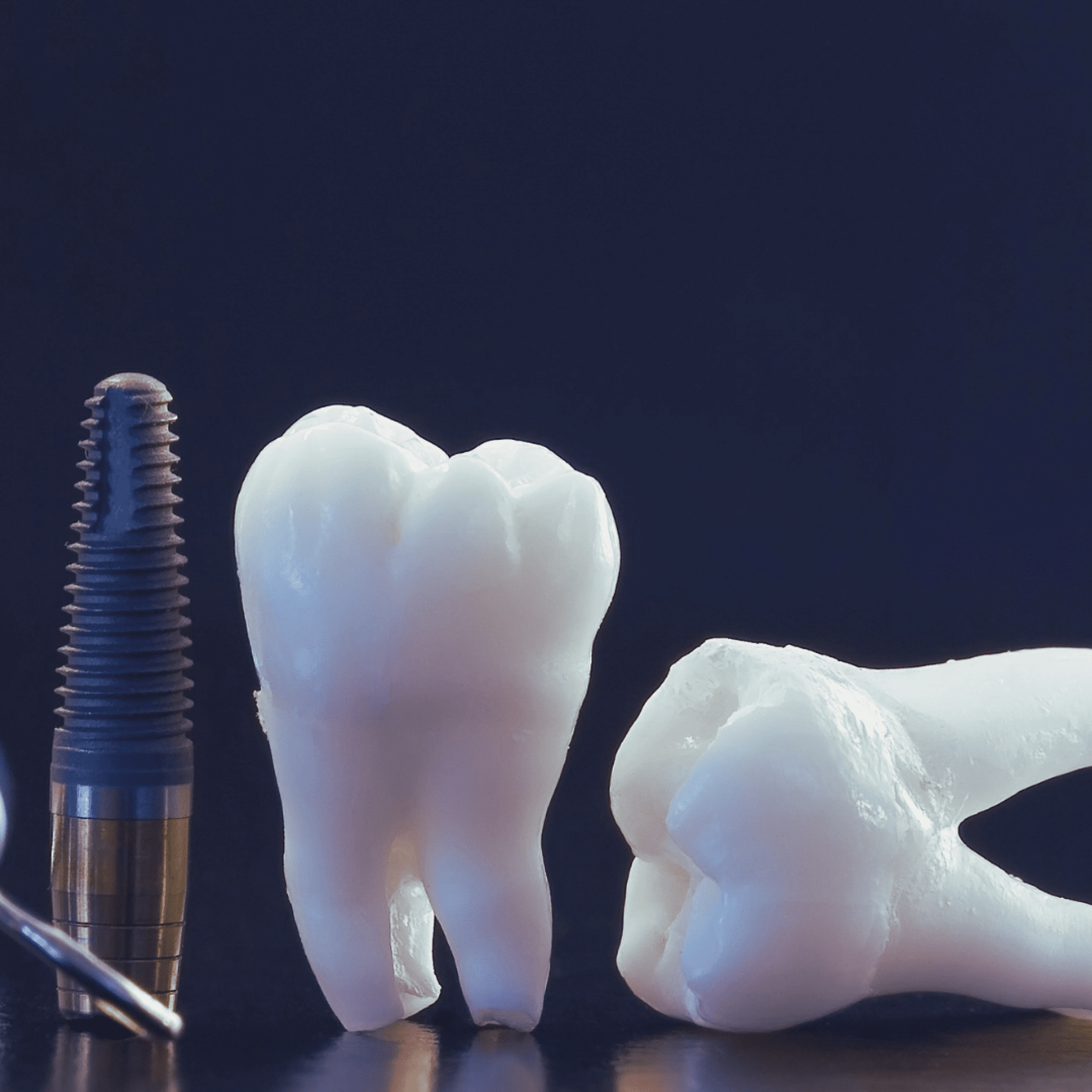Let's Learn About The NittyGritty Of Dental Implants!