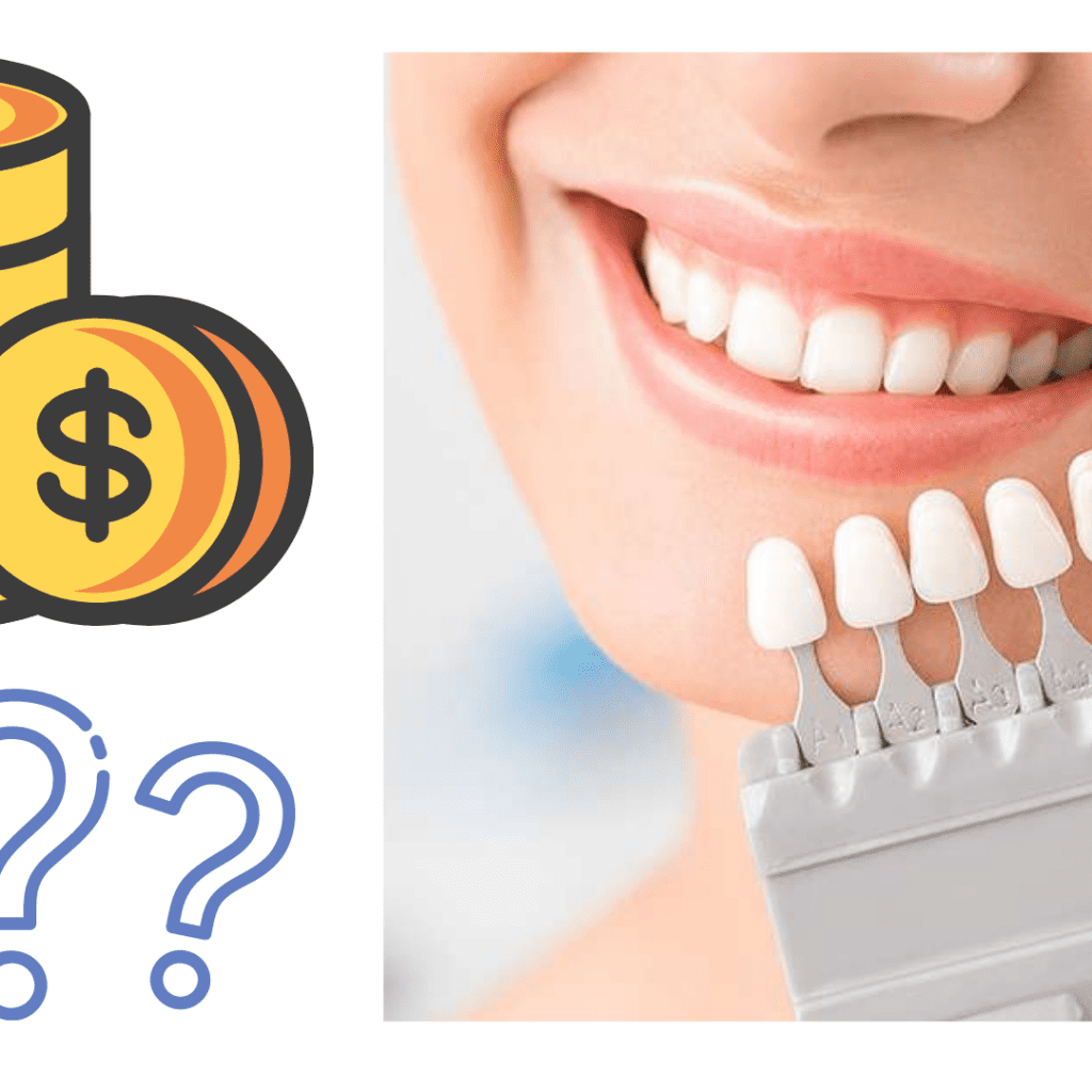 Dental Veneers: The Gateway To A Smile Makeover