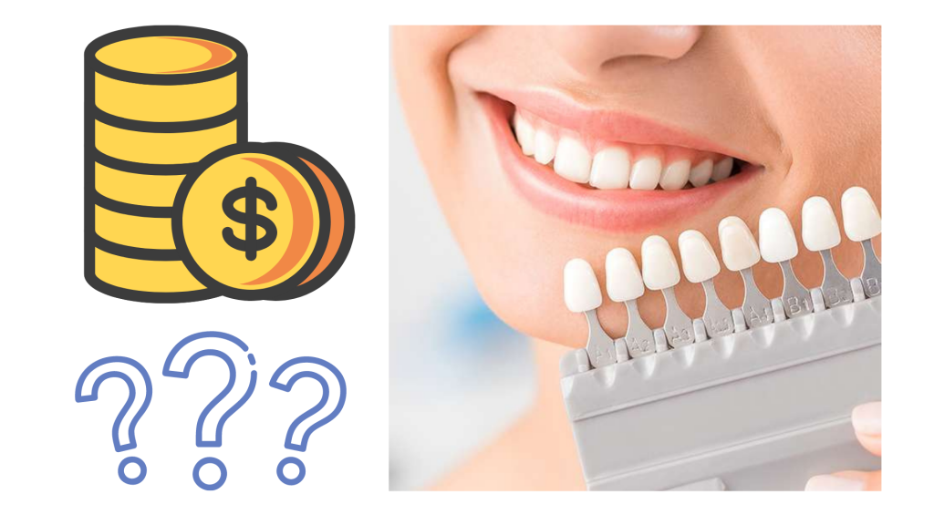 Dental Veneers How much do they cost