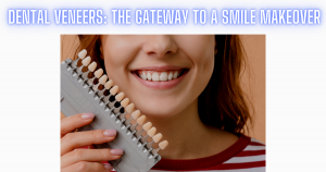 Dental Veneers: The Gateway To A Smile Makeover