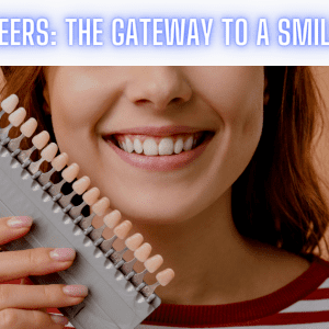 Read more about the article Dental Veneers: The Gateway To A Smile Makeover