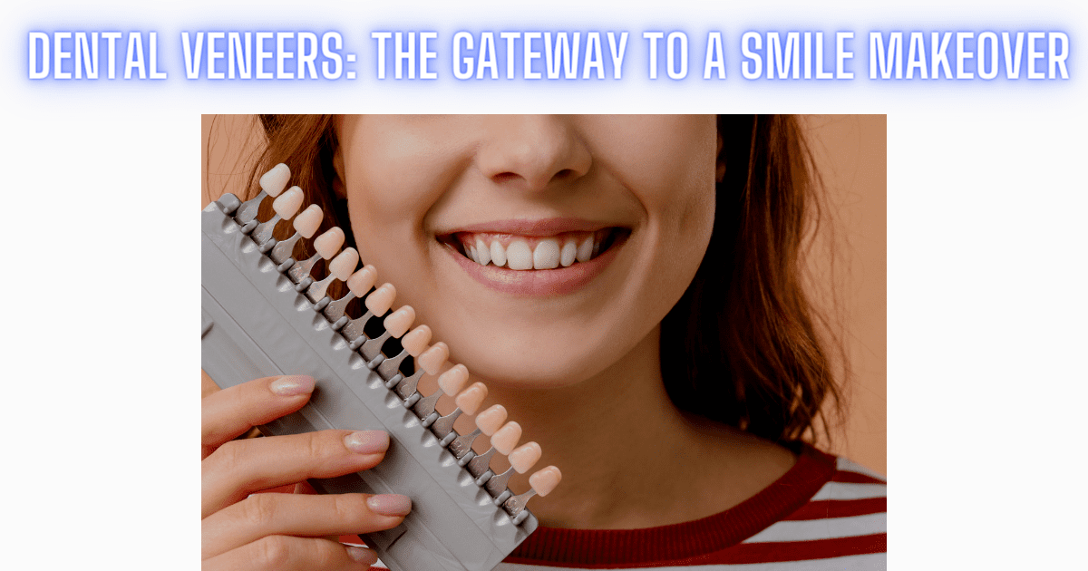 You are currently viewing Dental Veneers: The Gateway To A Smile Makeover
