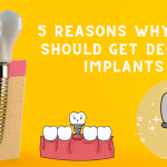 Read more about the article 5 Reasons Why You Should Get Dental Implants