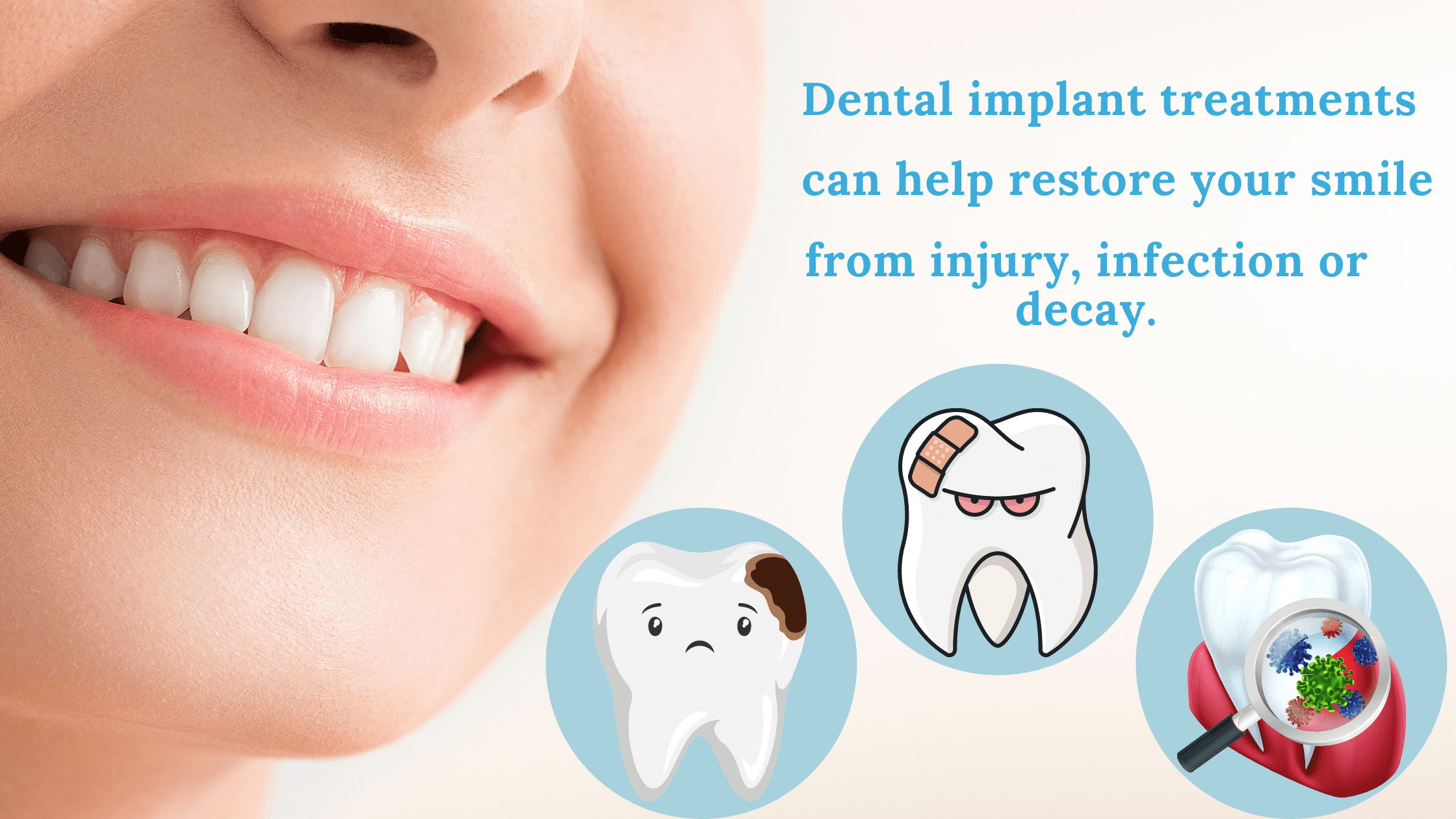 dental Implants treatment