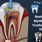 Read more about the article 7 Root Canal Myths and the Truths Behind Them