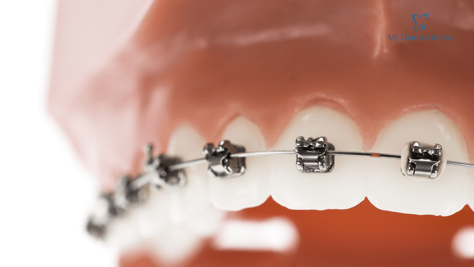 Orthodontics: The Unique Practice of Dentistry