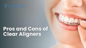 Read more about the article Embracing Transparency the Pros and Cons of Clear Aligners