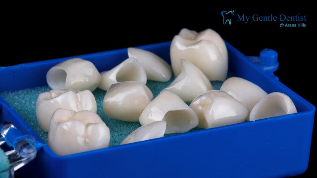 Dental Crowns