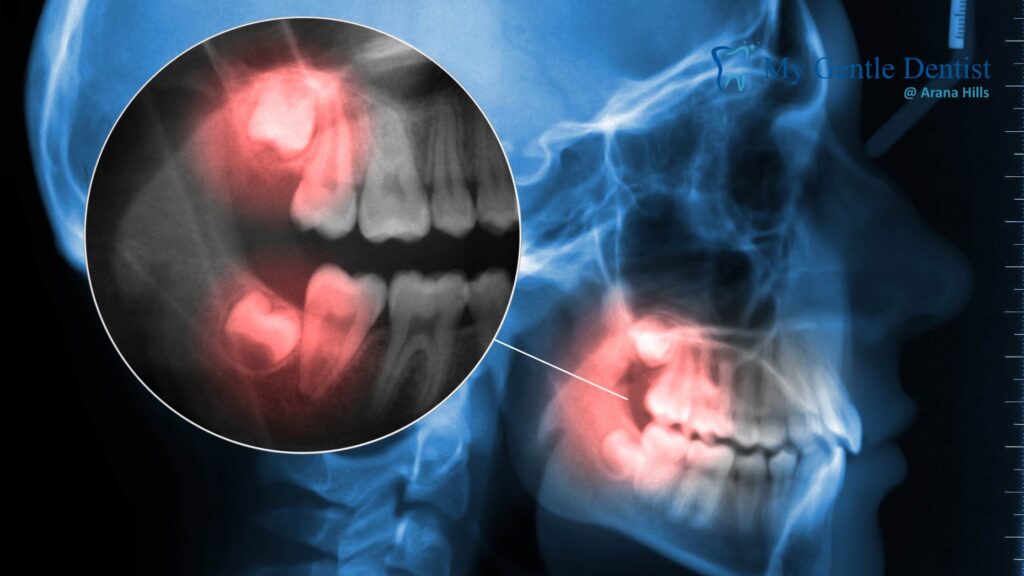 Emergency Dentists