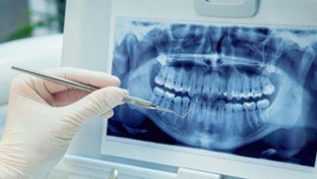 digital-xraya.jpg Teeth Dentist