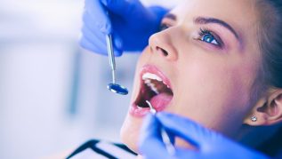examining-teeth-5-step-routine-checkup-clean-process.jpg Teeth Cleaning