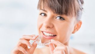 INVISALIGN TREATMENT COST – INVISALIGN DENTIST INVISALIGN TREATMENT COST - INVISALIGN DENTIST