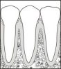 Gum Disease Treatment Dentist Gum Disease Treatment Dentist