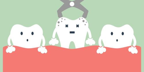 Tooth Extraction - Tooth extraction cost brisbane