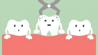 TOOTH EXTRACTION AND REMOVAL COST IN AUSTRALIA TOOTH EXTRACTION AND REMOVAL COST IN AUSTRALIA
